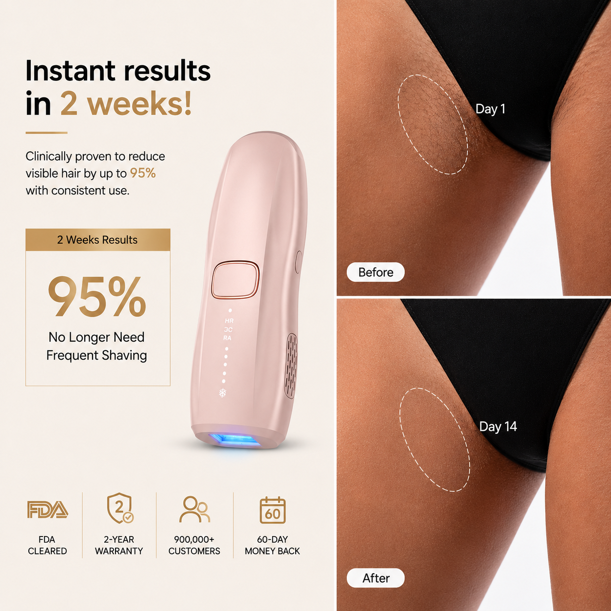 HEVELORA LumiFreeze Hair Removal Device Pro