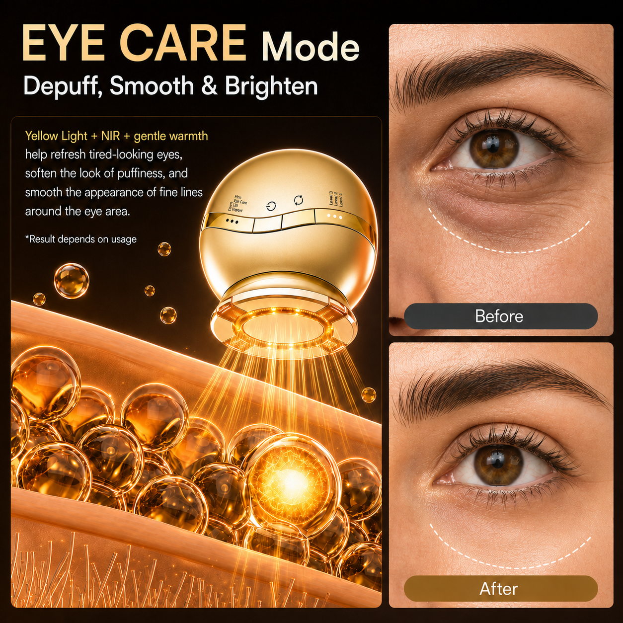 HEVELORA At-Home RF, EMS & LED Facial Rejuvenation Device