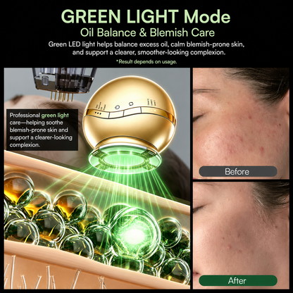 HEVELORA At-Home RF, EMS & LED Facial Rejuvenation Device