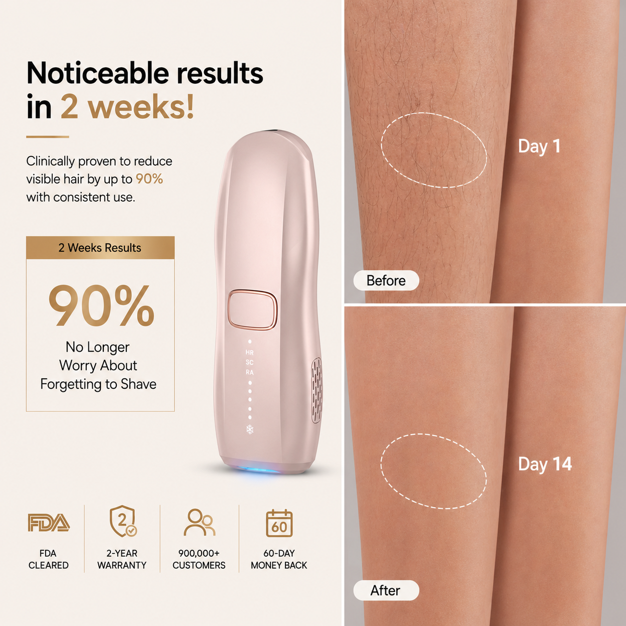 HEVELORA LumiFreeze Hair Removal Device Pro