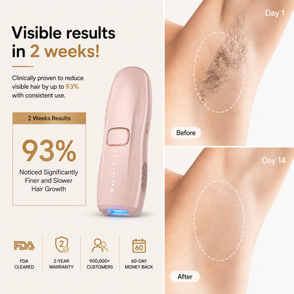 HEVELORA LumiFreeze Hair Removal Device Pro