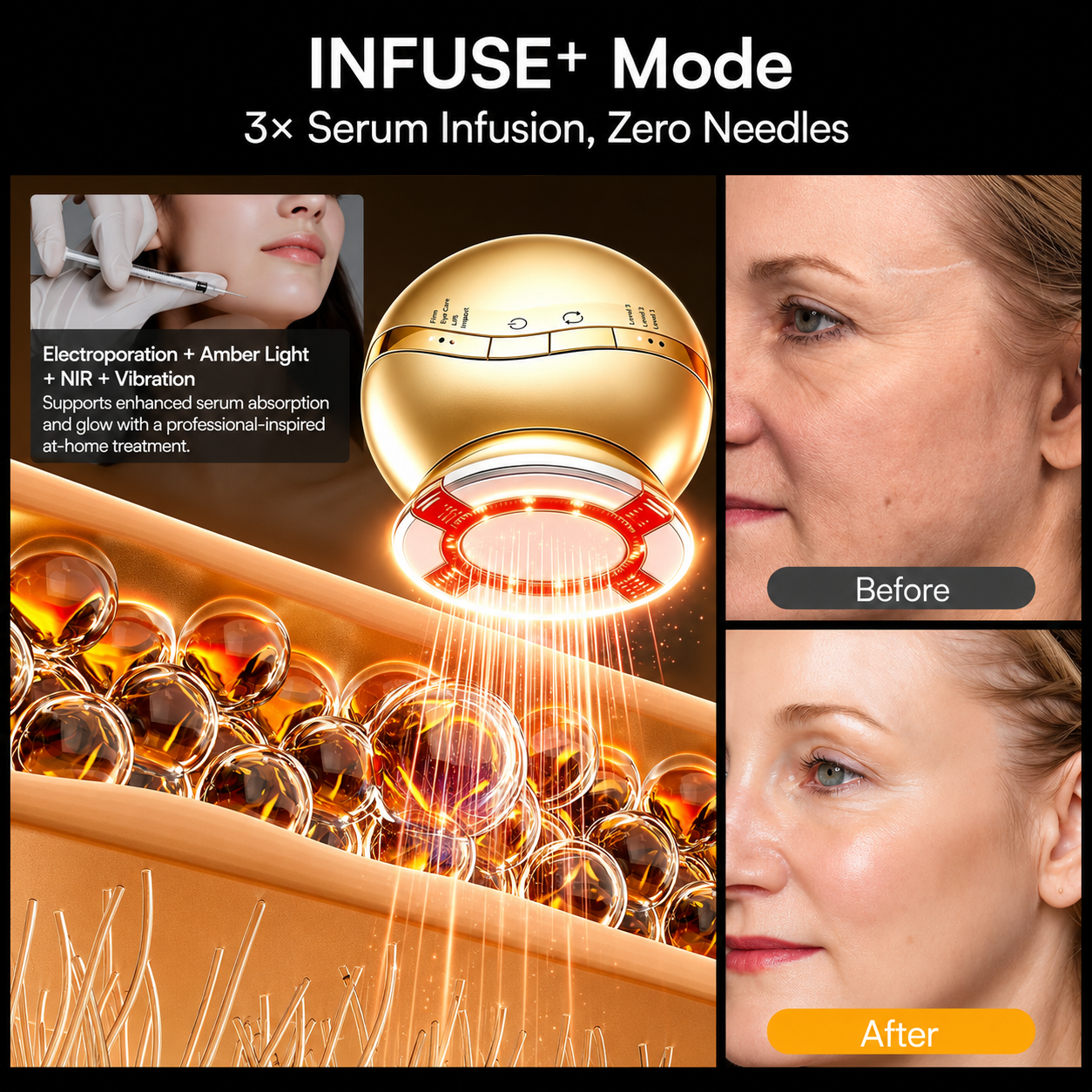 HEVELORA At-Home RF, EMS & LED Facial Rejuvenation Device