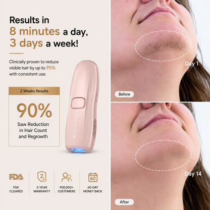 HEVELORA LumiFreeze Hair Removal Device Pro